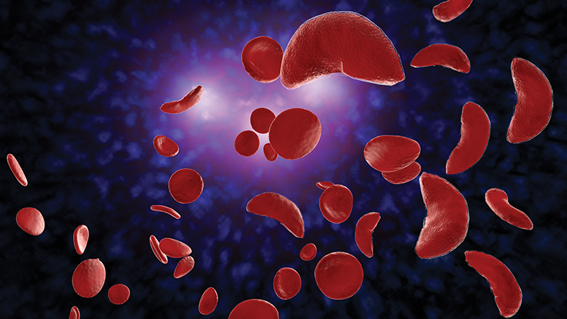 illustration of sickle-shaped blood cells